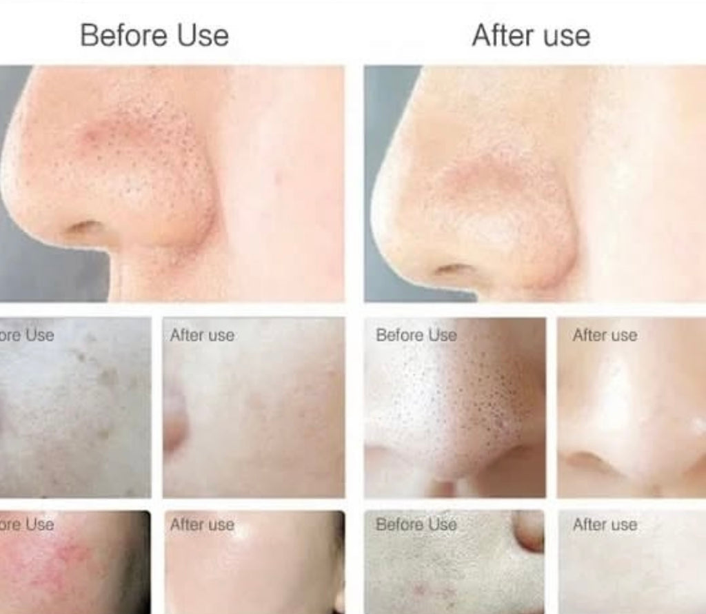 Face cleaning machine